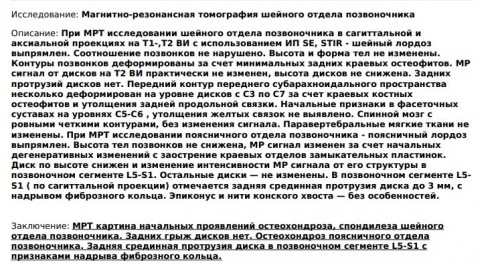 МРТ Моники.jpg