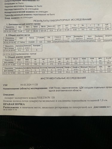 OjUfd56zW18.jpg