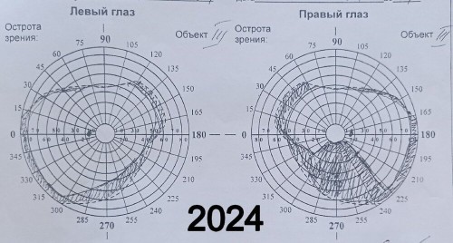 yCl7XTmTGBw.thumb.jpg.3cb801abaafea2cd594e2e1f5db09416.jpg