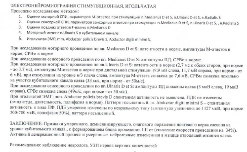энмг.png
