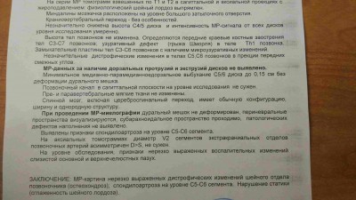 IMG_20170425_134011-min-min.jpg