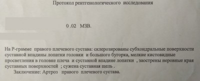 IMG_20171112_122025.jpg