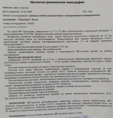 Снимок.PNG