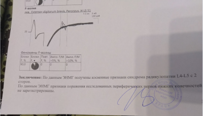 Снимок.PNG